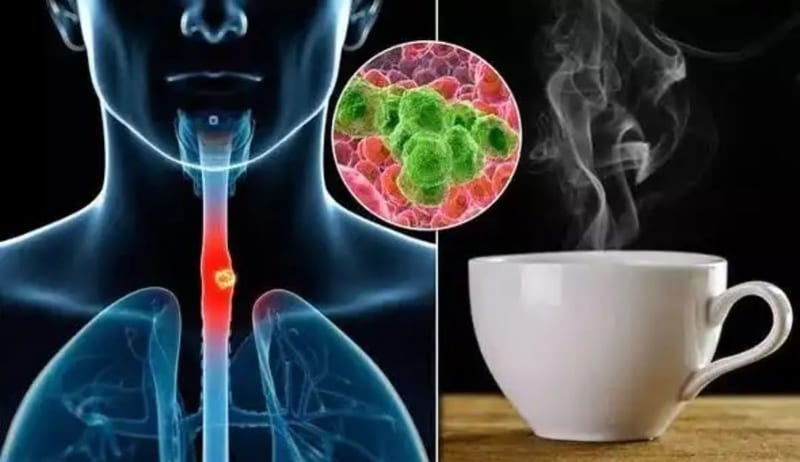Drinking Hot Tea Can Cause Cancer