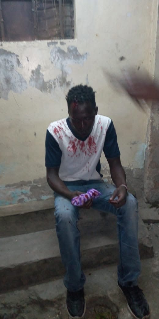 Graphic Images From Bamburi
