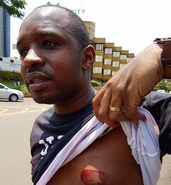 Celebrity Activist Boniface Mwangi Trolled