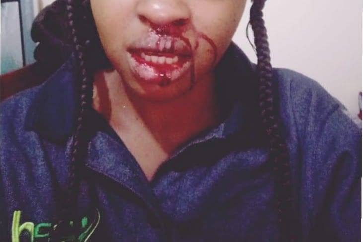 Photos: Lady accuses Technical University of Kenya student leader of physically abusing her
