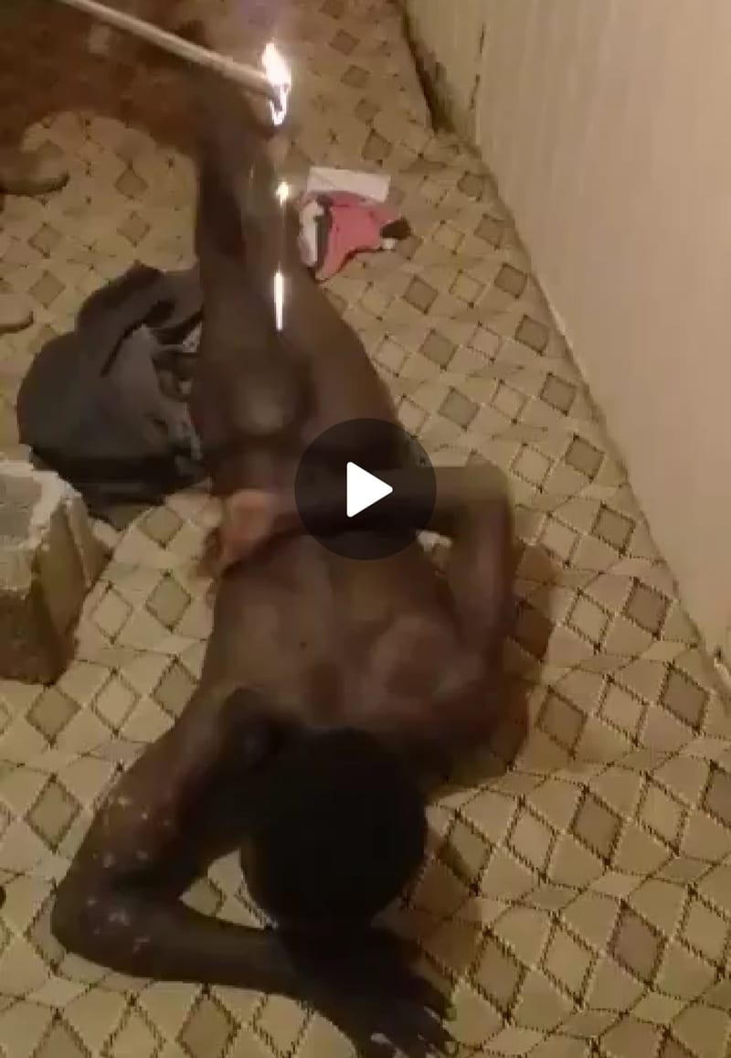 DISTURBING VIDEO — Arabs Pour Drops Of Melting Metal On A Black Man In The Middle East